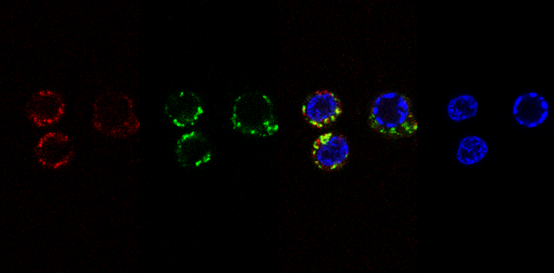 Fluorescent human cells seen through a microscope. Author provided